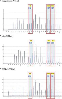 Cell-free fetal DNA as a non-invasive method using pyrosequencing in detecting beta-globin gene mutation: A pilot study from area with limited facilities in Indonesia